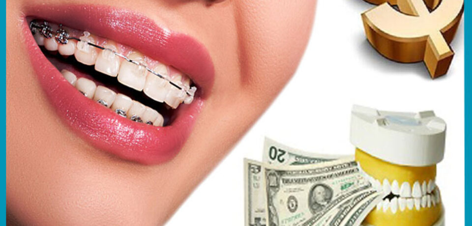 جدیدترین هزینه ارتودنسی دندان در تهران سال ۱۴۰۲